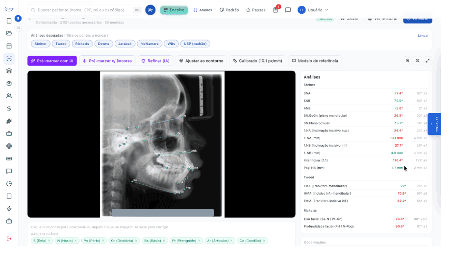 Radiologia com IA & cefalometria