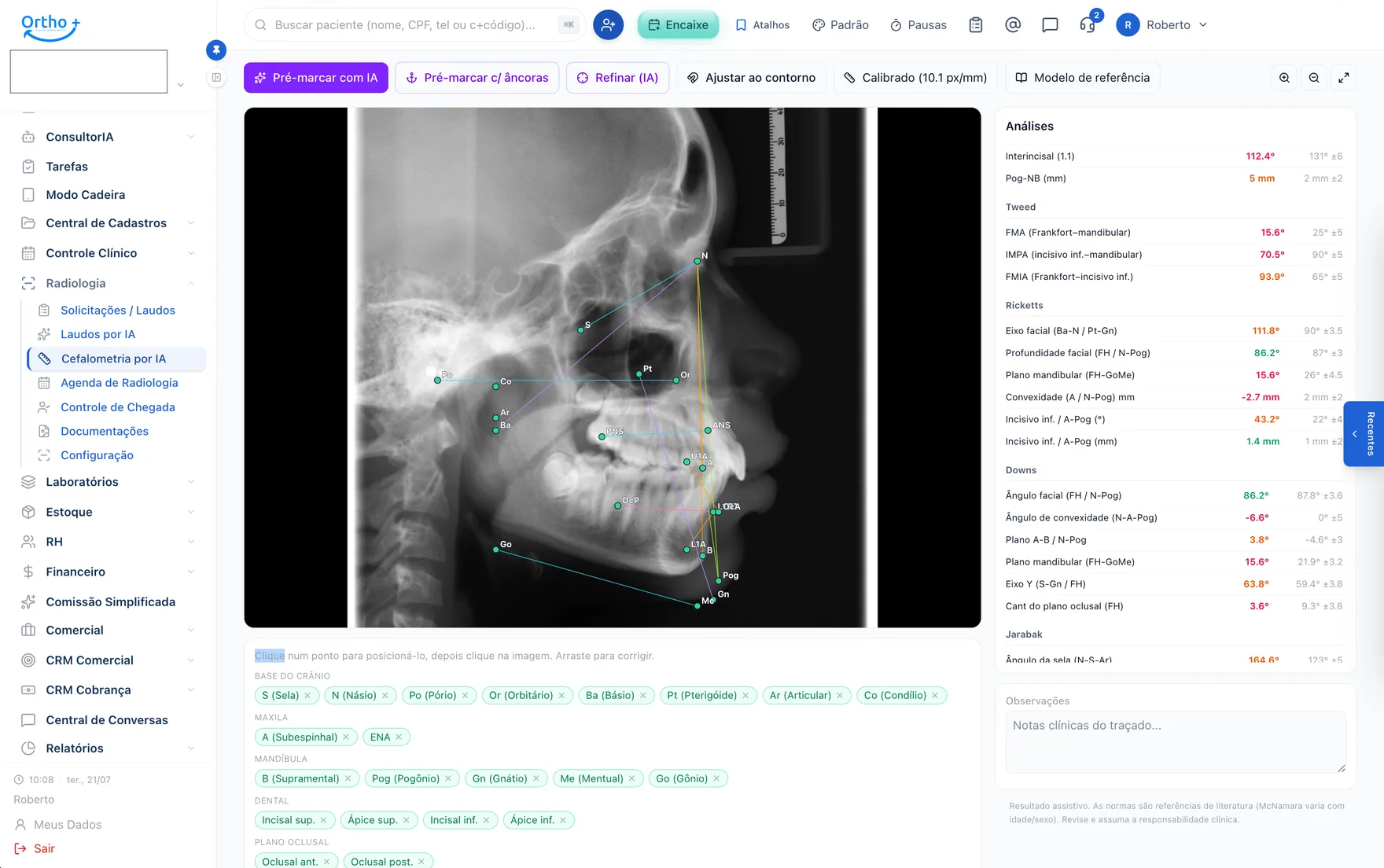 Radiologia com IA & cefalometria